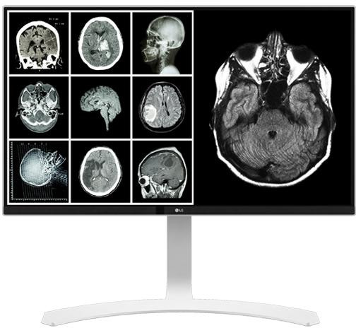 Monitor LED LG Clinical Review 27HJ712C-W 27 inch UHD IPS 14 ms 60 Hz DICOM
